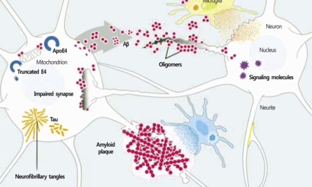 University of Minnesota scientists’ claim that beta-amyloid causes Alzheimer’s was FRAUD?