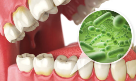 Bacteria in mouth linked to brain damage — we need FREE dental care for ALL!