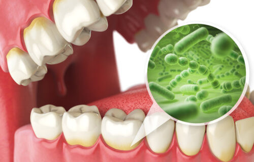 Bacteria in mouth linked to brain damage — we need FREE dental care for ALL!