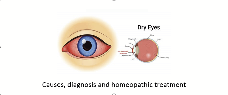 From corneal ulcers to Dry Eye